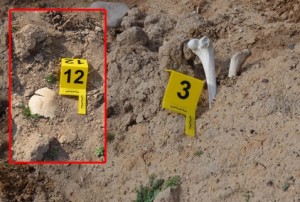 մարդկային ոսկորներ