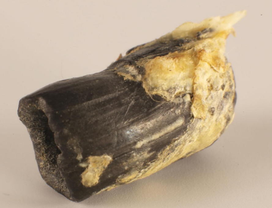 Ermeni kadının vücudunda bir Türk mermisi