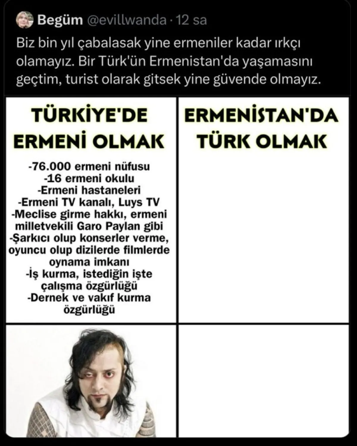 Hayko Cepkin’den “Türkiye’de Ermeni Olmak” Paylaşımında Fotoğrafını Kullanan Kişiye Kapak Gibi Cevap!